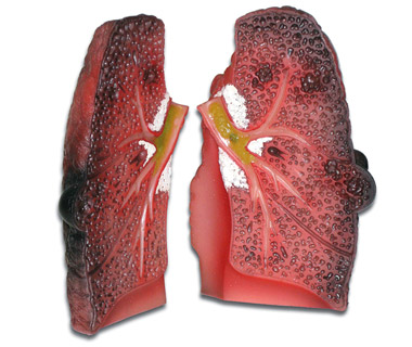 Lung Models